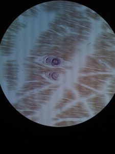 Trichinella spiralis (Encysted larvae) - Larve de ver enkystée, en spirale, logée entre des fibres musculaires